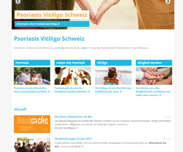 Psoriasis Vitiligo Schweiz 